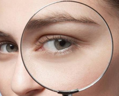 如何改善黑眼圈及眼袋